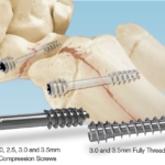 IBS-Hand-Screw-big03