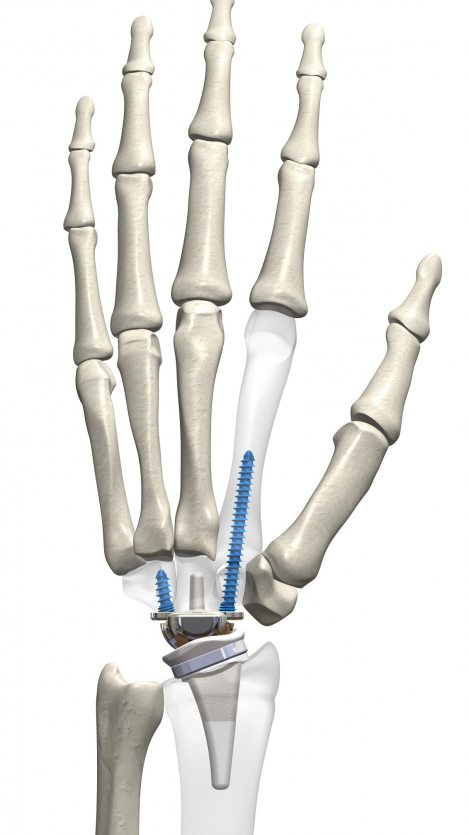 kinematx-hand-scaled-p82rb2akaazgkcikcgvlircptb2ohqmr76o4wb2km6